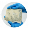 Allograft