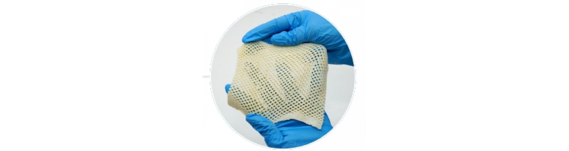 Allograft image