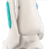 Arthroscopy