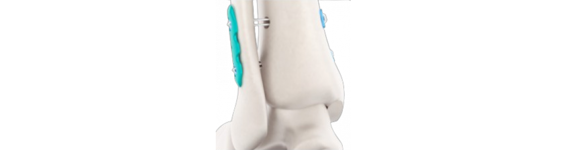 Arthroscopy image