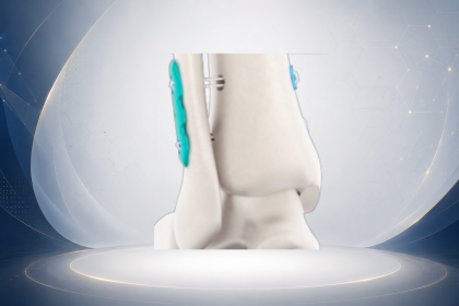 Arthroscopy Medical Solutions