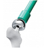 Arthroplasty