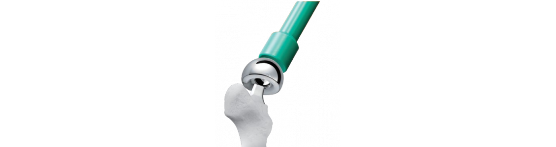 Arthroplasty image
