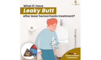 What if I have leaky butt after 
