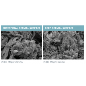Substrat Dermal Aselular AlloSource AlloSkin AC - Diedarkan oleh Prime Medical Concept Alograf Kulit Manusia Jenis Meshed Substrat Dermal Aselular AlloSource AlloSkin AC