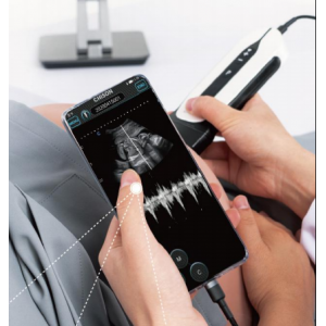 CHISON SonoEye Handheld Ultrasound System CHISON SonoEye Handheld Ultrasound System