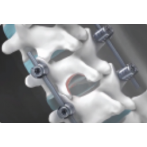 3DXT Cage & Instrument System