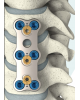 Sistem Plat Servikal Anterior ReBorn Essence - Diedarkan oleh Prime Medical Concept Sistem Plat Servikal Anterior ReBorn Essence BAUI Titanium Spine Implant