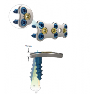 Sistem Plat Servikal Anterior ReBorn Essence (ReBorn Essence Anterior Cervical Plate System)