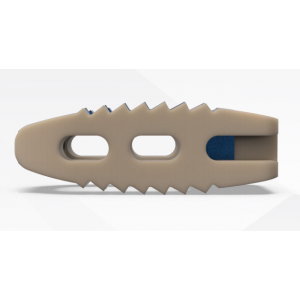 Sangkar Ti-PEEK CANIS oleh BAUI Spine Sangkar Ti-PEEK CANIS dengan struktur titanium berliang dan PEEK
