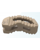 Sangkar Fusi Interbodi Lumbar ReBorn Essence COMET | Prime Medical Concept Sangkar Fusi Interbodi Lumbar ReBorn Essence COMET