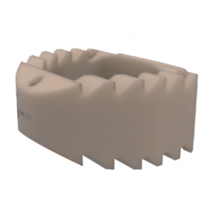 Sangkar Intervertebra Serviks PEEK ReBorn Essence®