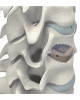Sangkar Intervertebra Serviks ReBorn Essence Venus | Prime Medical Concept Sangkar Intervertebra Serviks ReBorn Essence Venus