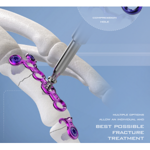 Set Sistem Plat Tangan AGOMED Panda - Diedarkan oleh Prime Medical Concept Plat Tangan Titanium AGOMED Panda dan Skru Pengunci Berkod Warna