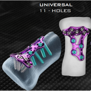 Sistem Plat Kepala Radial AGOMED Panda - Diedarkan oleh Prime Medical Concept Plat Kepala Radial Titanium AGOMED Panda bersama Skru Pengunci Kod Warna
