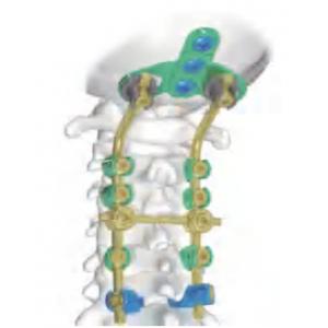 DEAN STRONG Anterior Cervical Plate System