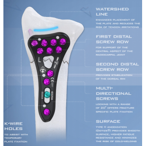 AGOMED King Kong Plating System 2.5 - Titanium Distal Radius & Ulna Plates and Screws Set